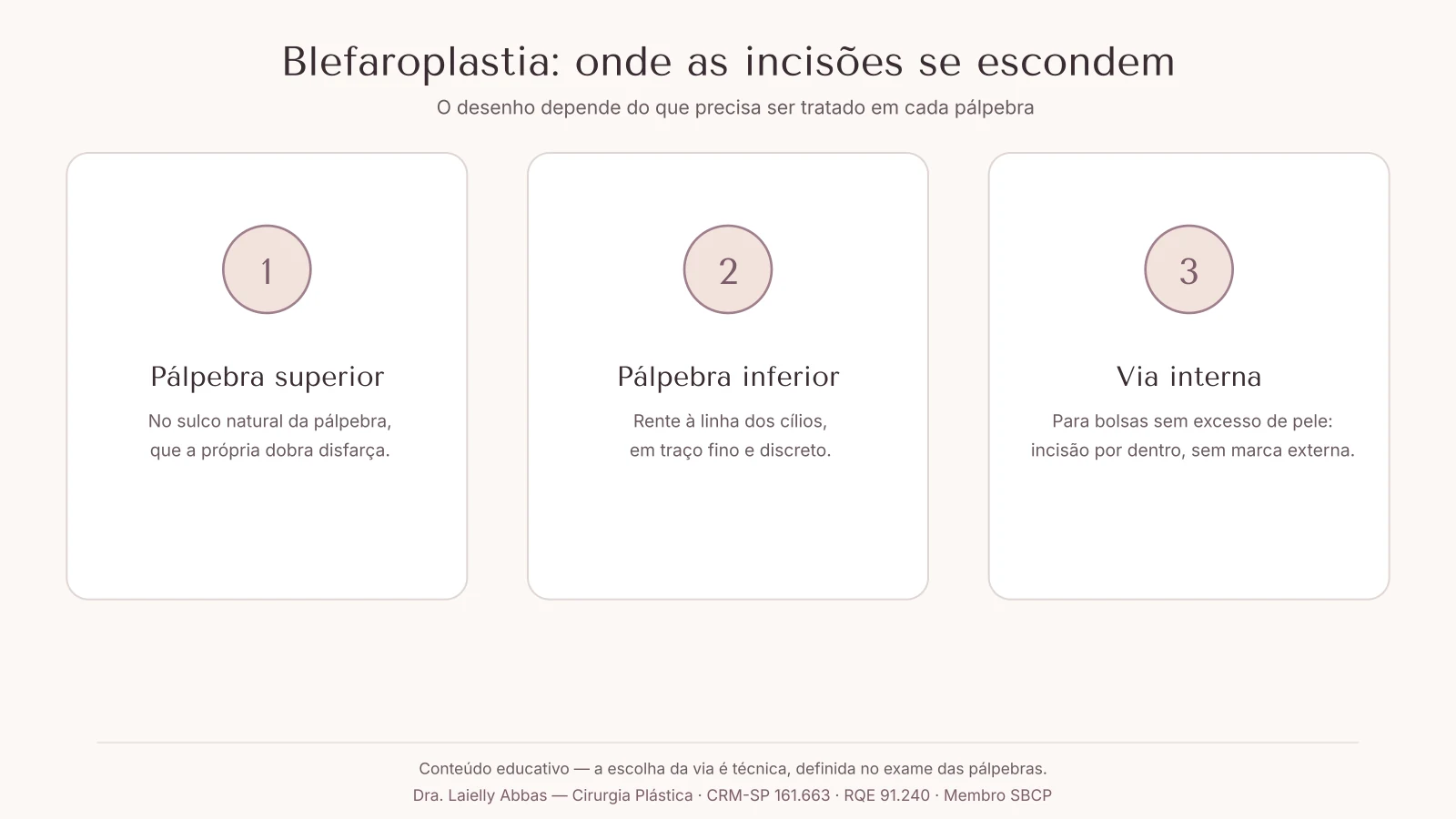 Diagrama com os três pontos discutidos sobre cicatrizes da blefaroplastia: sulco da pálpebra superior, rente aos cílios inferiores e via interna sem cicatriz na pele