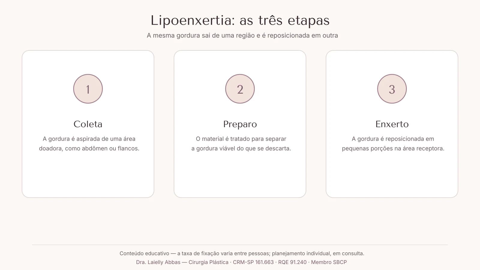 Diagrama com as três etapas da lipoenxertia: retirar a gordura de uma área doadora, preparar o material e enxertar na região receptora