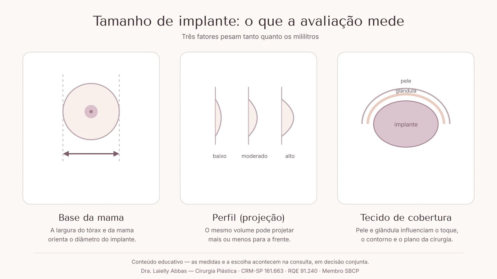 Três painéis esquemáticos: medida da base da mama, três perfis de projeção do implante e camadas de pele e glândula sobre o implante